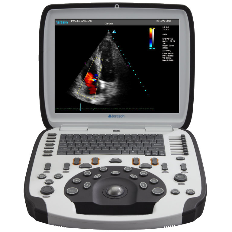 terason usmart 3300 ultrasound machine